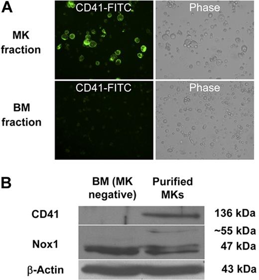 Figure 2. Detection of Nox1 protein in magnetic bead–purified MKs. (A) Example of enrichment of CD41-FITC–labeled MKs after purification of TPO-stimulated BM cultures as described in “Methods.” Purity was assessed by fluorescence microscopy. Images are shown at ×400 magnification. (B) BM was isolated and cultured for 3 days (+TPO) before magnetic bead purification. Western blots were probed with antibodies for CD41, Nox1, and β-actin.