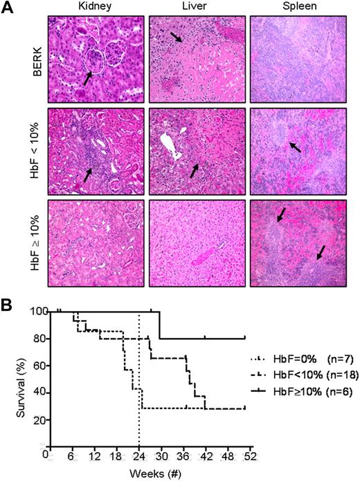 Figure 5. Correction of organ pathology in GbG≥10 mice that underwent transplantation after reduced-intensity conditioning and improved overall survival. (A) Representative hematoxylin-eosin–stained sections of a kidney, liver, and spleen of GbG≥10 and GbG<10 mice 48 to 50 weeks after reduced-intensity conditioning transplantation and a 3-month-old BERK control. Image acquisition information is available in supplemental data. (B) Kaplan-Meier survival curve showed significantly improved survival of the GbG≥10 mice compared with mock/GbG<10 mice at 50 weeks. Survival at 24 weeks is denoted by a dashed vertical line to compare with survival of the GbG mice in the myeloablative transplantation model (supplemental Figure 3c).
