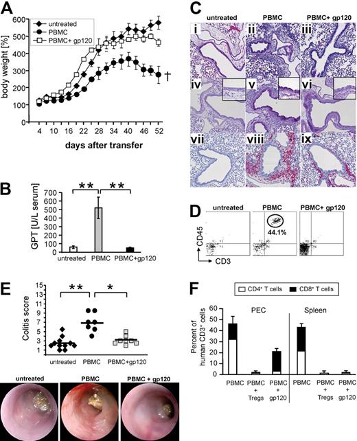 Figure 4. gp120 protects from GVHD. (A) 107 PBMC were injected with or without 5 μg gp120 into newborn NOD-Scid mice. Untreated mice served as controls. Each point represents the cumulative mean weight data of one group (5 mice per group; one of 5 experiments is shown). Survival of mice at day 52: untreated: 5/5; PBMC: 0/5; and PBMC + gp120: 5/5. (B) GTP serum levels of mice belonging to different groups 3 weeks after PBMC transfer. (C) Histologic pulmonary tissue analysis 4 weeks after PBMC transfer. (D) Representative flow cytometric analysis of bronchoalveolar lavage from mice belonging to different groups 3 weeks after PBMC transfer. (E) Colitis score and endoscopic pictures of mice belonging to different groups of mice 3 weeks after PBMC transfer. (F) Regulatory T cells and gp120 inhibiting expansion of human T effector cells in lymphoid tissues. Frequencies of human CD45+ leukocytes and the CD4:CD8 T-cell ratios in the CD45+ population 28 days after PBMC transfer are shown. Columns and error bars indicate average expression plus or minus SD of 3 different mice. One representative result of 3 is shown.