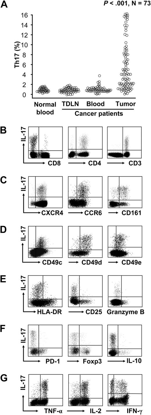 Figure 1. Distribution, phenotype, and cytokine profile of Th17 cells. Single-cell suspensions were made from fresh tumor specimens. The cells were subjected to membrane and intracellular staining and analyzed by FACS. One representative tumor specimen of 73 is shown in panels B to G. (A) The distribution of Th17 cells in patients with ovarian cancer. Results are expressed as the percentage of Th17 cells in CD4+ T cells in different tissues by gating on IL-17+CD4+CD3+ cells. Normal blood: n = 41. TDLN: Tumor-draining lymph nodes, n = 53. Cancer patient blood: n = 61. Ovarian cancer tissues: n = 73 (P < .001, compared with blood and TDLNs). (B) IL-17 expression in CD4+ and CD8+ T cells. IL-17 expression was analyzed in tumor-infiltrating CD45+ cells. (C) The expression of CXCR4, CCR6, and CD161 in tumor-infiltrating Th17 cells. (D) The expression of CD49C, CD49D, and CD49E in tumor-infiltrating Th17 cells. (E-F) The markers associated with T-cell activation/effector function and suppression. The expression of activation/effector molecules (CD25, HLA-DR, and granzyme B) in panel E and of suppression-associated molecules (PD-1, FOXP3, and IL-10) in panel F were analyzed in tumor-infiltrating Th17 cells. (G) The effector cytokine profile of Th17 cells. The cytokine profile was analyzed in tumor-infiltrating Th17 cells.