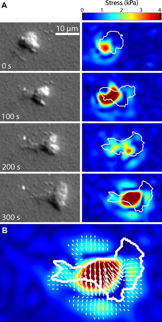 Figure 6. Distribution of tractional stresses in a migrating neutrophil. (A) A time series of images showing a neutrophil migrating chemokinetically to the right on a 10-kPa gel. The DIC images show that the cell has moved over a full body length in 300 seconds (supplemental Video 2). The images to the right of the DIC images are the corresponding traction images for those time points. The white outline over the traction images represents the approximate boundary as determined from the DIC images. The largest stresses occurred in the posterior of the neutrophil, a feature independent of gel stiffness. The full series of images for this particular example can be seen in supplemental Video 3. (B) A larger version of the last traction image in the series from panel A is shown. The white arrows represent the overall direction and magnitude of the applied tractional stresses. The few large tractions in the center of the cell were balanced by more numerous small tractions in the surrounding areas.