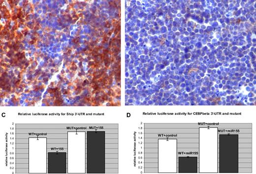 Figure 4. Ship and C/ebpβ are direct targets of miR-155. (A) Spleen, immunohistochemistry, 200×. SHIP-1 is highly expressed in normal B and T lymphocytes (Olympus BX41 microscope and software; the bar represents 200 μm). (B) Malignant lymphocytes do not stain for SHIP-1 due to the loss of its expression. (C-D) Luciferase activity assay for Ship-3′-UTR and C/ebpβ, wild-type and mutant, after the control (□) and miR-155 (■) transfections in 293 cells.