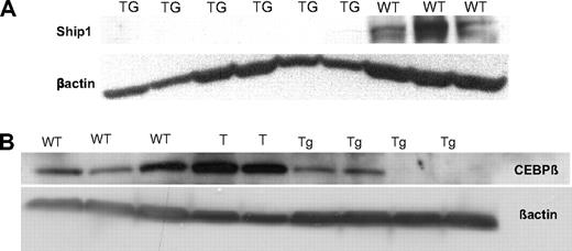 Figure 5. The Ship and C/ebpβ down-regulation in the miR-155 transgenic splenocytes compared with the wild-type splenocytes occurs mainly in the B-cell precursors rather than in the mature B cells. (A-B) Western blots on proteins extracted from total splenocytes show the lack of expression of SHIP-1 (A) and C/EBPβ (B) in the leukemic compared with the wild-types. Note: The samples marked “T” are 2 T-cell leukemias arisen in the miR-155 transgenic mice.