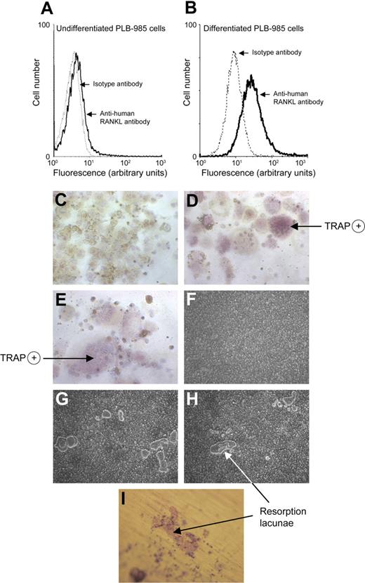 Figure 1. PLB-985 neutrophil–like cells express RANKL and mediate monocyte maturation into OCs. Flow cytometric analysis of RANKL expression by undifferentiated PLB-985 cells (A) and by PLB-985 cells differentiated for 48 hours with dbcAMP (B). Cells were incubated with an anti–human RANKL mAb followed by a FITC-conjugated anti–mouse F(ab′)2 antibody. Isotype controls are dotted tracings. Results are representative of 5 independent experiments. Monocytes isolated from peripheral blood of healthy human donors were incubated (C) with M-CSF (25 ng/mL) alone, (D) with M-CSF + rhRANKL (40 ng/mL), and (E) with M-CSF + PLB-985 cells (106/well) differentiated for 48 hours with dbcAMP and subsequently fixed with 2% PFA. After 10 days of incubation, cells were stained for TRAP to evaluate TRAP-positive multinucleated cells by light microscopy. (C-E) Magnification, ×200. Mature OCs (100 000/well) on Osteologic discs were incubated (F) with M-CSF (25 ng/mL) alone, (G) with addition of PFA-fixed PLB-985 neutrophil-like cells, and (H) with addition of rhRANKL (40 ng/mL). Cells were removed after 10 days of incubation and bone resorption was evaluated by light microscopy and Imagepro software. (I) Mature OCs deprived of exogenous RANKL were incubated on dentine discs with PFA-fixed PLB-985 neutrophil-like cells. After 10 days, dentine discs were stained with toluidine blue (0.5%). Results were reproduced in 3 independent experiments. (F-I) Magnification, × 100.