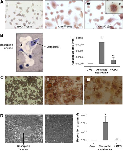 Figure 4. Activated human neutrophils mediate functional osteoclastogenesis from human monocyte precursors. (A) TRAP expression by osteoclast precursors in culture with activated neutrophils: human monocytes were incubated with (i) M-CSF (25 ng/mL), (ii) M-CSF + exogenous rhRANKL (40 ng/mL), and (iii) M-CSF + LPS-activated neutrophils (106/well). After 10 days, TRAP-positive multinucleated cells were observed with light microscope. Results were reproduced in 3 independent experiments. (i-iii) Magnification, × 200. (Inset, iii): Enlarged view of a TRAP-positive multinucleated cell in coincubation with activated neutrophils (magnification, ×400). (B) Formation of resorption pits in neutrophil-osteoclast cocultures: mature OCs deprived of exogenous RANKL were incubated on Osteologic discs for 10 days in the presence of activated neutrophils and were then stained by toluidine blue vital coloration. Osteoclasts (multinucleated giant cells) are visualized in the interior and in the periphery of the resorption lacunae. Histograms represent total resorption area by mature human OCs incubated on Osteologic discs in the absence of exogenous RANKL and activated neutrophils (C-ve), and in the presence of activated neutrophils (106/well) with or without 2 μg/mL recombinant OPG. Results are expressed in square millimeter (mm2) of resorption area (mean ± SEM, n = 3 independent experiments). Statistical analysis: unpaired t test, *P < .002, **P < .003 (activated neutrophils vs C-ve; activated neutrophils vs activated neutrophils + OPG). (C) TRAP expression by osteoclast precursors in culture with neutrophil membranes: monocytes were incubated with (i) M-CSF (25 ng/mL), (ii) M-CSF + exogenous rhRANKL (40 ng/mL), and (iii) M-CSF + membranes of LPS-activated neutrophils added at a cellular equivalent of 500 000 cells/well. After 10 days of cultures, TRAP-positive cells were observed with light microscope (i-iii: magnification, ×200). Results were reproduced in 3 independent experiments. (D) Formation of resorption pits in cultures of osteoclasts with neutrophil membranes: mature OCs without exogenous RANKL were incubated on Osteologic discs with (i) membranes of activated neutrophils added at a cellular equivalent of 500 000 cells/well, and (ii) conditioned medium from activated neutrophils (200 μL/well). Formation of resorption pits was evaluated after an additional 10 days of coculture. Histograms represent total resorption area by mature human OCs incubated on Osteologic discs in the absence of exogenous RANKL and neutrophil membranes (C-ve), and in the presence of membranes from activated neutrophils (cellular equivalent of 500 000 cells/well) with or without 2 μg/mL recombinant OPG. Results are expressed in square millimeter (mm2) of resorption area (mean ± SEM, n = 3 independent experiments). Statistical analysis: Student unpaired t test, *P < .02, +P < .02 (neutrophil membranes vs C-ve; neutrophil membranes vs neutrophil membranes + OPG).