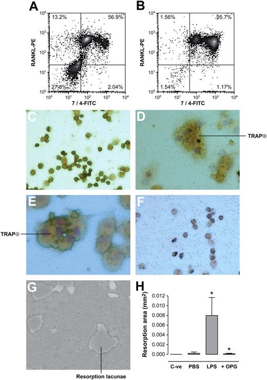 Figure 5. Neutrophils from LPS-injected mouse air pouch express RANKL and mediate functional osteoclastogenesis from murine monocyte-macrophage RAW264.7 cells. Cells obtained from (A) PBS-injected and (B) LPS-injected air pouches were labeled with a FITC-conjugated anti–mouse neutrophil antibody (clone 7/4), and PE-conjugated anti-mRANKL antibody simultaneously. Nonspecific sites were blocked by murine Fc block for 1 hour. Graphs represent flow cytometric analysis of pooled neutrophils from 5 mice/group and are representative of 3 such groups. Percentages in each quadrant correspond to numbers of cells present in each quadrant relative to 10 000 cells counted. RAW264.7 mononuclear cells were incubated (C) with medium (DMEM + 10% FBS) alone, (D) with medium + 20 ng/mL recombinant murine RANKL, (E) with medium + murine neutrophils (2.5 × 105/well) from LPS-injected air pouches, and (F) with medium + murine neutrophils (2.5 × 105/well) from LPS-injected air pouches and preincubated with 1 μg/mL recombinant OPG for 1 hour at 37°C. After 5 days of incubation, TRAP-positive multinucleated cells were analyzed by light microscopy (magnification, ×200). Results shown are representative of 3 independent experiments. (G) RAW264.7 cells (2 × 104/well) deposited on Osteologic discs were incubated with murine neutrophils (2.5 × 105/well) from LPS-injected air pouches. Cells were removed after 10 days of culture and resorption lacunae were observed under light microscopy (magnification, ×100). (H) Histograms represent total resorption area by RAW264.7 cells incubated in the absence of exogenous RANKL and neutrophils (C-ve), and in the presence of murine neutrophils (2.5 × 105/well) from PBS- or LPS-injected air pouches with or without 1 μg/mL recombinant OPG. Results are expressed in square millimeter (mm2) of resorption area (mean ± SEM, pool of 5 mice/group representative of 4 such groups). Statistical analysis: unpaired t test, *P < .05 (LPS vs PBS; LPS vs + OPG).