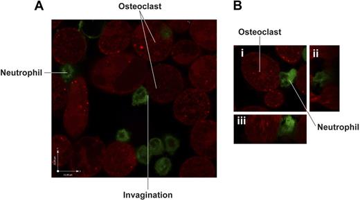 Figure 6. Confocal microscopy analysis of the interaction between activated neutrophils and human monocyte-derived OCs. (A) LPS-activated human neutrophils prelabeled with PKH67 green fluorescent linker were incubated for 1 hour at 37°C with mature OCs previously labeled with CellTracker Orange CMTMR. Cells were washed vigorously to eliminate nonadherent neutrophils and visualized by live-confocal microscopy using Olympus Fluoview microscope (magnification, ×1500). (B) Details of cell-cell contact between activated neutrophils and OCs: (i) stacking view; (ii) z plan of y-axis; (iii) z plan of x-axis.
