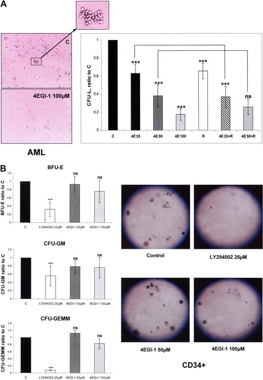 Figure 1. 4EGI-1 dramatically reduces the clonogenic growth of AML progenitors with a moderate impairment of normal CD34+ hematopoietic progenitor clonogenicity. (A) AML blast cells from 5 patients were plated in H4230 methylcellulose medium without or with 25, 50, or 100 μM 4EGI-1 (4E25, 4E50, and 4E100, respectively), 10 nmol/L RAD001 (R), or the association of RAD001 with 25 μM or 50 μM 4EGI-1. Cells were then incubated for 7 days, and the leukemic colonies (> 20 cells), referred to as CFU-L, were scored under an inverted microscope. In the control condition, the numbers of CFU-L were 66 to 258 in 5 independent experiments. (B) Normal CD34+ cells were purified from 5 healthy donors and then plated as described in “Colony assays,” without or with 50 or 100 μM 4EGI-1. The BFU-E, CFU-GM, and CFU-GEMM colony-forming units were counted under an inverted microscope. In the control condition, the numbers of colonies were 82 to 118, 43 to 58, and 11 to 15 for BFU-E, CFU-GM, and CFU-GEMM, respectively, in 5 experiments. Each histogram represents the mean of 5 independent experiments, performed in duplicates. Results are expressed as a ratio between each condition and the control condition. Vertical bars represent SD. ***P < .001. ns indicates not significant.