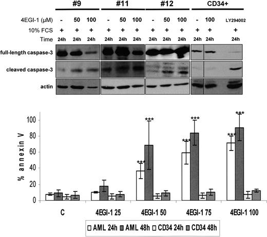 Figure 2. 4EGI-1 induces a high level of apoptosis in AML blast cells but not in normal CD34+ hematopoietic progenitors. Caspase-3 cleavage: AML blast cells from 3 different AML patients were cultured 24 hours in 10% FCS MEM without or with 50 or 100 μM 4EGI-1. The same experimental procedure was applied in 3 CD34+ samples, and 25 μM LY294002 was used as a control for apoptosis induction (1 representative sample is provided). Protein extracts from 106 cells were resolved by SDS-PAGE electrophoresis, transferred to nitrocellulose, and probed with anti–caspase-3 and antiactin antibodies. Annexin V binding: 2 × 105 cells were cultured without or with increasing concentrations of 4EGI-1 (from 25 to 100μM) during 24 or 48 hours, and then labeled with annexin V–PE for flow cytometry analysis. Results are expressed as a mean of experiments done on 5 primary AML samples and on 5 different CD34+ samples. Vertical bars represent SD. ***P < .001.