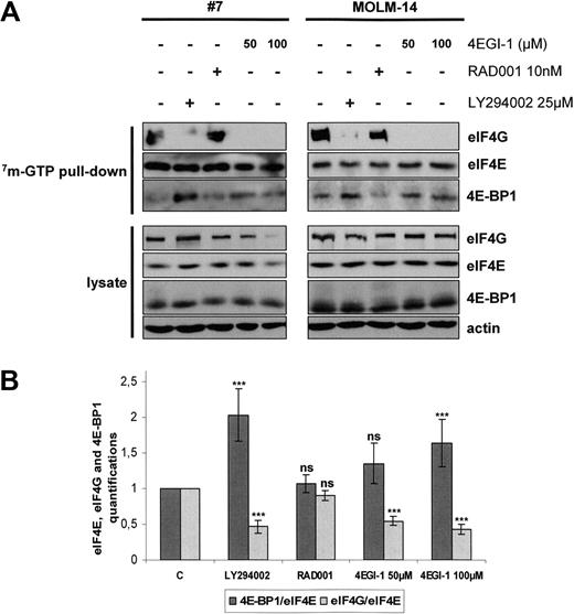 Figure 4. EIF4F complex formation is mTORC1-independent in AML and is totally abrogated by the 4E-BP1 mimetic 4EGI-1. (A) Blast cells from 6 AML patients and from the MOLM-14 leukemic cell line were cultured for 24 hours in αMEM containing 10% FCS without or with 10 nM RAD001, 25 μM LY294002, or 50 or 100 μM 4EGI-1, and then lysed. Supernatants were clarified, m7-GTP affinity assay was performed, and beads were solubilized in boiling Laemmli sample buffer. Western blots were performed with anti-eIF4G, anti-eIF4E, and anti–4E-BP1 antibodies. (B) Quantifications of the signal intensity of Western blots from the 6 m7-GTP affinity assay experiments performed in primary AML samples were done using the Multi Gauge, Version 3.0 software from Fuji. Each histogram represents the mean of 6 independent experiments, and results are expressed as the ratio between 4E-BP1 and eIF4E and between eIF4G and eIF4E, relative to the control condition (C; extracts from cells incubated without inhibitor). Vertical bars represent SD.