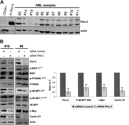 Figure 7. Pim-2 is constantly expressed in AML and controls 4E-BP1 S65 phosphorylation and subsequent cap-dependent translation in AML. (A) Samples from AML patients or normal CD34+ hematopoietic cells from healthy donors were starved for 4 hours in cytokine- and serum-free medium. A total of 106 cells were lysed in boiling Laemmli sample buffer and Western blot for Pim-2 was performed, with 50 ng of human recombinant Pim-2 (rh Pim-2, from Cell Signaling Technology) as control for Pim-2 detection. Actin was used as the loading control. (B) Pim-2 siRNA or nontargeted control siRNA were transfected into AML blast cells, with the Amaxa nucleofector system. At 24 hours after electroporation, cell extracts were analyzed by Western blot to assess the expression of Pim-2, c-Myc, Cyclin D1, P70S6K, 4E-BP1, BAD, and actin and the phosphorylation level of P70S6K on T389, BAD on S118, and of 4E-BP1 on T37/46 and S65 residues. The signal intensity was quantified using the Multi Gauge, Version 3.0 software from Fuji. Each histogram represents the mean of 4 independent experiments, and results are expressed as a ratio between the Pim-2, c-Myc, Cyclin D1, or the phospho-4E-BP1 S65 signals and the actin signal, relative to the control condition. Vertical bars represent SD.