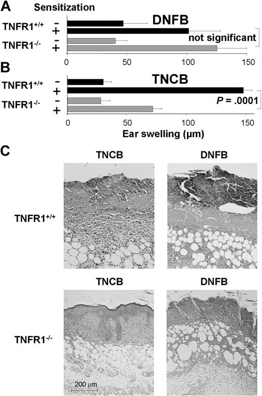 Figure 1. DNFB induces strong tissue necrosis in TNFR1+/+ mice. (A) DNFB-sensitized and -challenged TNFR1+/+ mice developed reduced ear swelling responses 24 hours after ear challenge compared with TNFR1−/− mice (n = 5-7). (B) TNCB-sensitized and -challenged TNFR1−/− mice developed reduced ear swelling responses 24 hours after ear challenge compared with TNFR1+/+ mice (n = 16-27). (C) Enhanced tissue necrosis in TNFR1+/+ mice after DNFB application. Hematoxylin and eosin–stained abdominal skin sections from TNCB-treated (top left) or DNFB-treated (top right) TNFR1+/+ and from TNCB-treated (bottom left) or DNFB-treated (bottom right) TNFR1−/− mice at day 5 after hapten application on the abdomen (n = 3-5).