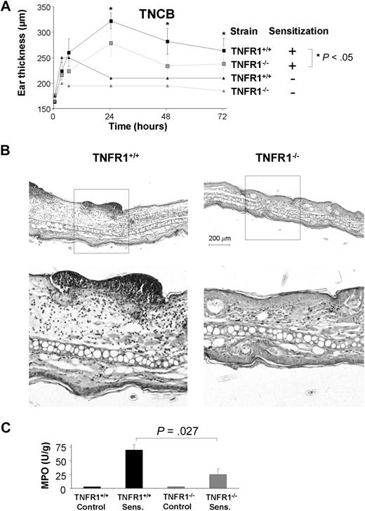 Figure 2. Impaired TNCB-specific DTHRs in TNFR1−/− mice. (A) TNCB-sensitized and naive TNFR1−/− () and TNFR1+/+ (■) mice were challenged with TNCB. Ear thickness was measured before and at the indicated time points after TNCB challenge. Differences in ear thickness between TNFR1−/− () and TNFR1+/+ (■) were significant (P < .05) 24, 48, and 72 hours after ear challenge (24 hours: n = 16-27; 48 hours and 72 hours: n = 6 or 7). (B) Reduced PMN infiltrates, tissue necrosis, and edema in ear tissue from TNFR1−/− mice 24 hours after TNCB challenge. Hematoxylin and eosin–stained ear sections from TNFR1+/+ (left: top represents overview; bottom represents detail) and TNFR1−/− mice (right: top represents overview; bottom represents detail; n = 13-15). (C) PMN recruitment is TNFR1-dependent. MPO activity in protein extracts from ear tissue from TNFR1−/− and TNFR1+/+ mice (n = 3).