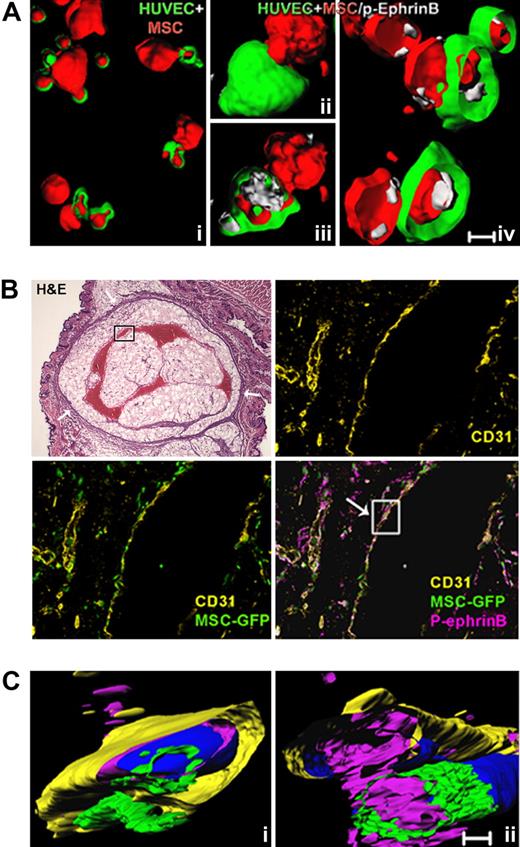 Figure 5. EphrinB is phosphorylated at sites of contact between endothelial cells and MSC. (A) Cell surface and interior rendering of representative confocal images showing MSC (red) contacting HUVEC (green), and p-EphrinB (white) at points of contact between HUVEC and MSC after 1-hour incubation on Matrigel. Subpanels iii and iv are the result of clipping to show the cell interior. (B) Representative microscopy images from H&E staining of a sectioned Matrigel plug (oval structure limited by a drawn black line), showing vessels containing remnants of red cells (red structures) and the overlying skin (original magnification ×1.2); and fluorescence immunostaining of human CD31 and p-EphrinB in sequential sections from the boxed area within the Matrigel plug containing HUVEC and GFP-MSC retrieved from the mouse after 7 days (original magnification ×20). (C) Three-dimensional rendering of confocal images from 2 segments of the boxed vessel wall in panel B showing the relationship between CD31+ endothelium, GFP-labeled MSC, and p-EphrinB. Images reflect clipping and rotation to show relationships between cell types and p-EphrinB. Scale bars in panels A and C represent 50 μm.