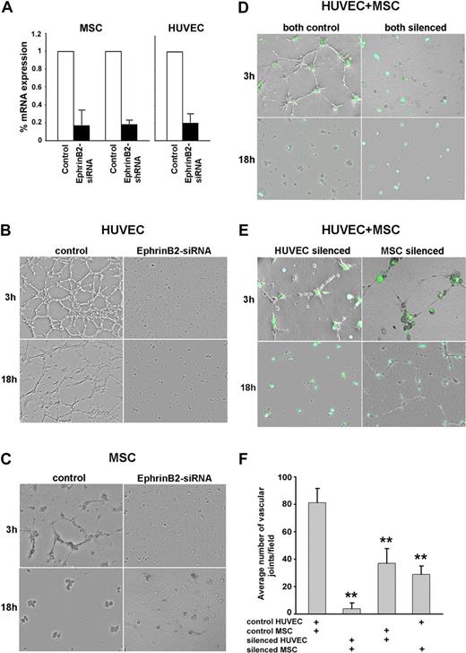Figure 6. EphrinB2 silencing in HUVEC and MSC reduces cord formation. Reduction of EphrinB2 mRNA levels in HUVEC and MSC by silencing with siRNA or shRNA measured by real-time RT-PCR. The results reflect the means (± SD) of 3 independent experiments (A). Representative images from Matrigel-supported cultures of control and EphrinB2-silenced (siRNA) HUVEC (B), control and EphrinB2-silenced MSC (siRNA) (C), cocultures of HUVEC and MSC (both silenced: HUVEC by siRNA, MSC by GFP-shRNA) (D), and cocultures of HUVEC and MSC in which HUVEC or MSC was silenced (E). Network formation in Matrigel-supported cocultures of HUVEC (control or siRNA) and MSC (control or shRNA) was measured as the mean number of angles (± SD) generated by intersecting cords from 3 separate experiments; ** P < .01 (F).