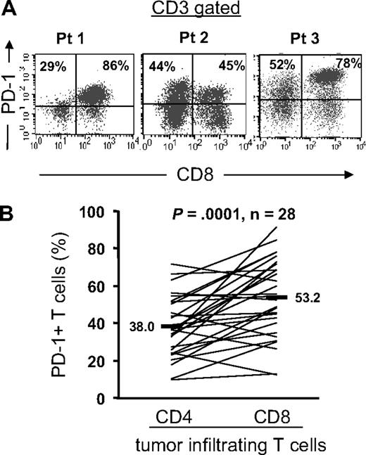 Figure 1. Expression of PD-1 by CD4 and CD8 T cells infiltrating into tumors. Cryopreserved tumor digests from patients with metastatic melanoma (Pt) were thawed and immediately stained with CD3, CD8, and PD-1 mAbs. (A) The dot plots were gated on CD3+ lymphocytes. Quadrants were set based on isotype control mAbs. The percentages represent the fraction of PD-1+ T cells in CD8 T cells (top right) or CD4 T cells (top left). CD3+ CD8− T cells were considered CD4 T cells throughout the study. (B) The percentage of PD-1+ CD4 T cells per total CD4 T-cell population and PD-1+ CD8 T cells per total CD8 T-cell population in tumor digests from 28 patients with metastatic melanoma is shown. P value was calculated using the paired t test.