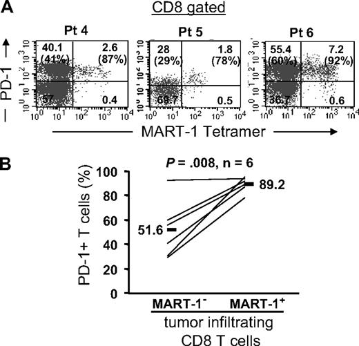 Figure 2. Tumor antigen–specific CD8 T cells express PD-1 in tumors. Tumor digests from patients were thawed and immediately stained with anti-CD3, anti-CD8, and anti–PD-1 mAb and MART-1 tetramer. (A) Three representative patients are shown. The dot plots were gated on CD3+ CD8+ lymphocytes. The numbers represent the percentage of CD3+ CD8+ T cells for each quadrant, and the percentage values represent the fraction of PD-1+ T cells in MART-1 tetramer+ CD8 T cells (top right) and in MART-1 tetramer− CD8 T cells (bottom left). (B) The overall frequency of PD-1+ T cells in MART-1 tetramer− (MART-1−) and MART-1 tetramer+ (MART-1+) tumor-infiltrating CD8 T cells is shown for 6 patients. P value was calculated using the paired t test.