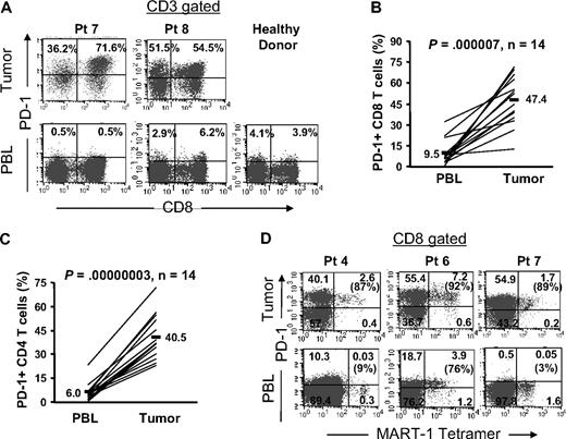 Figure 3. PD-1 is predominantly expressed by tumor-infiltrating T cells compared with peripheral blood T cells. Cryopreserved tumor digests from patients with metastatic melanoma (Pt) and PBL from the same patients and healthy donors were thawed and immediately stained with CD3, CD8, and PD-1 mAbs. (A) Dot plots were gated on CD3+ lymphocytes. The percentage for each quadrant represents the fraction of PD-1+ T cells in CD8 T cells (top right quadrant) or in CD4 T cells (top left quadrant). These were representative of 14 patients and 7 healthy donors. (B) The percentage of PD-1+ CD8 T cells per total CD8 T-cell population and (C) the percentage of PD-1+ CD4 T cells per total CD4 T-cell population were quantified in PBL and tumor digests from the same patients (n = 14). P value was calculated using the paired t test. (D) In 3 patients who had detectable circulating MART-1 tetramer CD8 T cells in their peripheral blood, we compared PD-1 expression on MART-1 tetramer+ CD8 T cells in tumor digest samples versus those in peripheral blood in the same patients as described in Figure 2.