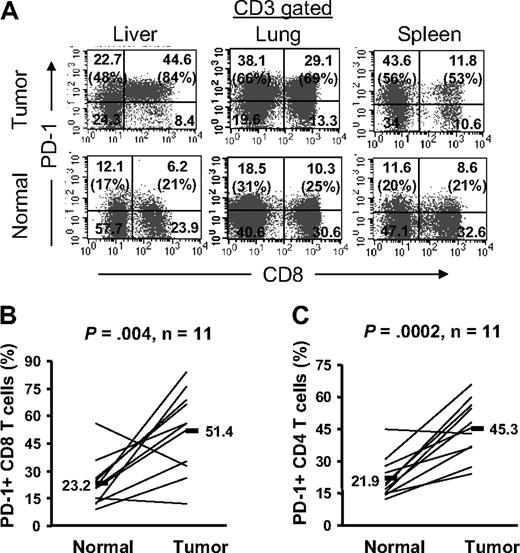 Figure 4. The frequency of PD-1+ T cells is significantly higher in tumor than adjacent normal tissue. Cryopreserved tumor digests (Tumor) and normal tissue digests (Normal) isolated from the same patients were thawed and immediately stained with CD3, CD8, and PD-1 mAbs. (A) The dot plots were gated on CD3+ lymphocytes. Quadrants were set based on isotype control mAbs. Numbers represent the percentages of T cells in each quadrant and the percentage values represent the fraction of PD-1+ T cells in CD8 T cells (top right quadrant) and CD4 T cells (top left quadrant). The percentage of PD-1+ CD8 T cells per total CD8 T-cells population (B) and PD-1+ CD4 T cells per total CD4 T-cell population (C) in tumors and normal tissues for 11 patients with metastatic melanoma are shown. P value was calculated using the paired t test.