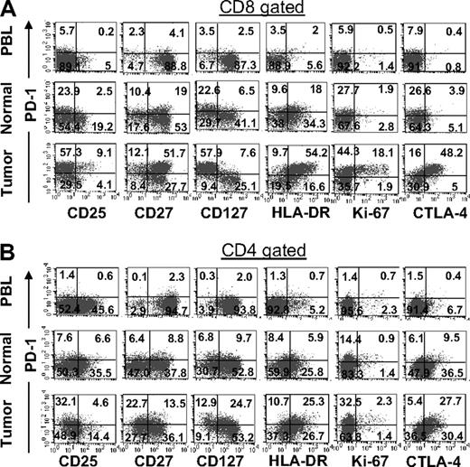 Figure 5. Phenotypic comparison of CD8 and CD4 T cells infiltrating into tumor, normal tissue, and peripheral blood in the same patient. Cryopreserved digests from a tumor metastasized into lung (Tumor), normal lung tissue (Normal), and peripheral blood lymphocytes (PBL) from the same patient were thawed and immediately stained with CD3, CD8, PD-1 mAbs, and appropriate marker as described in “Flow cytometric analysis.” For CD8 T cells, dot plots were gated on CD3+CD8+ lymphocytes (A) and for CD4 T cells dot plots were gated on CD3+CD8− lymphocytes (B). The numbers represent the percentages of CD8 or CD4 T cells in each quadrant. This is representative of 8 independent experiments from patients with metastatic melanoma lesions and normal tissue isolated from lung (n = 6), liver (n = 1), and spleen (n = 1).