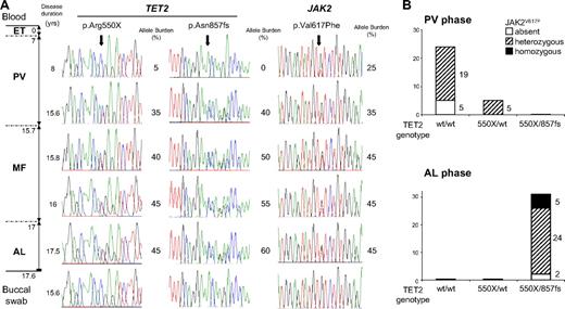 Figure 2. Sequential study of TET2 mutations and JAK2V617F in patient P4 (F3) in mononuclear cells and committed progenitors. (A) Sequence electrophorograms are shown for each TET2 mutation and for JAKV617F. (Left diagram) The different phases of the disease with their time lapse from diagnosis. (Right diagram) The disease duration (in years) at each sample date. Allele burdens of TET2 mutations and JAK2V617F, semiquantitatively estimated by sequencing as Bellanne-Chantelot et al,2 are indicated. (B) Histograms show for PV and acute leukemia (AL) phases the 3 distinct TET2 genotypes (each bar corresponding to a specific genotype, wt/wt, 550X/wt, 550X/857fs). The JAK2V617F mutation was absent, heterozygous, or homozygous. The number of genotyped clones is indicated for each group.
