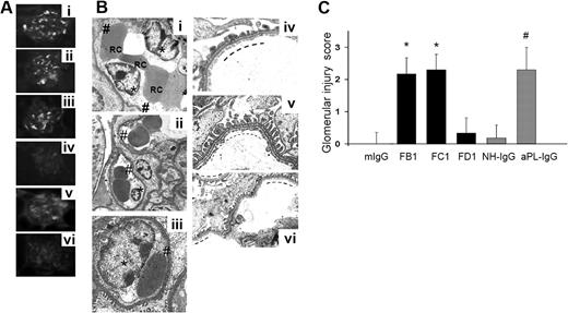 Figure 1. FB1, FC1, and aPL-IgG induced glomerular histologic lesions characteristic of TMA. (A) Binding of antibody FB1 (i), FC1 (ii), FD1 (iii), mouse IgG (iv), aPL-IgG (v), and NH-IgG (vi) to renal glomeruli after in vivo administration. Note that all mouse aPL antibodies and human aPL antibodies bind to glomeruli. (B) Transmission electron micrographs of glomeruli (original magnification ×7000). Swelling of glomerular capillary loops endothelial cells (*) and loss of fenestrations (#) were observed in glomeruli from FB1- (i), FC1- (ii), and aPL-IgG–treated mice (iii). Note the numerous red blood cells (RC) trapped between swollen endothelial cells. No signs of endothelial injury, well-preserved fenestrations (—), and widely patent glomerular capillary lumina are observed in kidneys from mouse IgG- (iv) and NH-IgG-treated mice (v; control groups). Similar to kidneys from mouse IgG-treated mice, no signs of endothelial injury were observed in glomeruli from FD1-treated mice. In FD1-treated mice (vi), glomerular capillary lumina are patent, fenestrations are well preserved (—), and endothelial cells are not swollen. Six or 7 mice were studied in each experimental group. (C) Glomerular injury scores. EM was evaluated in a semiquantitative way. These scores were obtained by independent study by 2 scientists, and the scoring of all tissues was conducted in a blinded manner. FB1, FC1, and aPL indicate that IgG-treated mice showed the higher glomerular injury scores compared with control mice.