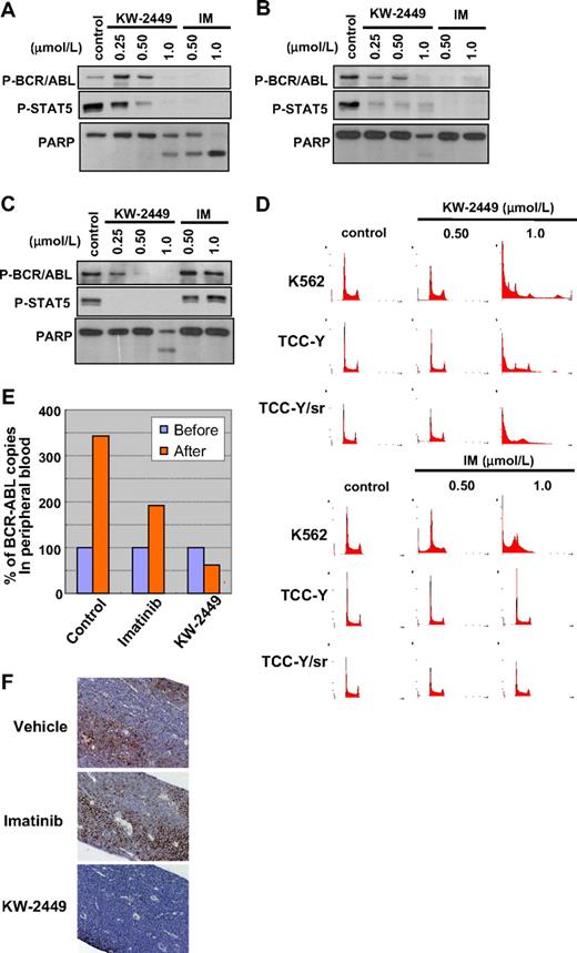 Figure 7. Inhibitory effects of KW-2449 on BCR/ABL-positive leukemia cells. We compared inhibitory effects on wt (K562 and TCC-Y) and T315I-mutated (TCC-Y/sr) BCR/ABL-expressing human leukemia cells between KW-2449 and imatinib (IM). (A) In K562 cells, KW-2449 and IM equally decreased the phosphorylation levels of BCR/ABL and STAT5 and increased cleaved PARP. (B) In TCC-Y cells, IM decreased the phosphorylation levels of BCR/ABL and STAT5, but did not increase cleaved PARP. In contrast, KW-2449 decreased the phosphorylation levels of BCR/ABL and STAT5 and increased cleaved PARP. (C) In TCC-Y/sr cells, IM did not affect the phosphorylation levels of BCR/ABL and STAT5, whereas KW-2449 decreased both phosphorylation levels and increased cleaved PARP. (D) DNA contents were also compared between KW-2449 and IM treatments. IM increased the number of the G1-arrested cells only in K562 cells. However, KW-2449 induced the G2/M-arrested cells in K562, TCC-Y, and TCC-Y/sr cells. (E) We compared the antileukemic efficacy in NOD/SCID mice xenotransplanted with human CML in blast crisis cells harboring the T315I mutation after IM treatment. The treatment effects on the leukemia cells in PB are shown by the after/before BCR/ABL transcript ratio. After the treatment, the BCR/ABL transcript levels in PB increased to 3.391 plus or minus 1.071 and 1.927 plus or minus 0.332 times as much as those before the treatment in the vehicle- and IM-treated mice, respectively. In contrast, KW-2449 significantly decreased BCR/ABL transcript levels as to 0.553 ± 0.288 times as much as those before the treatment compared with the vehicle- and IM-treated mice (P = .001 and P = .003 by the unpaired t test, respectively). (F) Residual leukemia cells in femora were evaluated by the immunohistochemical staining with human CD45. KW-2449 more potently eradicated leukemia cells in BM than IM.