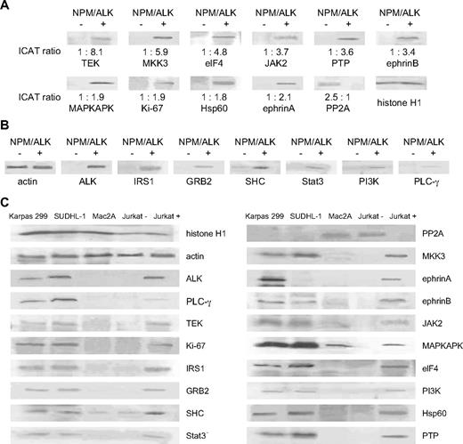 Figure 3. Western blot analyses corroborate cICAT liquid chromatography–MS/MS studies and show parallel expression in NPM/LK-positive cell lines. (A) The differential expression identified by cICAT liquid chromatography–MS/MS was validated by Western blot analysis using control LacZ (NPM/ALK-negative) and NPM/ALK-transfected Jurkat cells (NPM/ALK positive). Expression of TEK, MKK3, eIF4, Jak2, PTP1B, ephrinB, MAPKAPK, Ki-67, Hsp60, ephrinA, and PP2A was compared with the cICAT ratios shown at the bottom of the Western blots. Histone H1 was used as protein loading control. (B) Up-regulated expression of ALK, and proteins previously reported to be mediators of NPM/ALK (IRS1, GRB2, SHC, Stat3, PI3-K, and PLCg), is corroborated by Western blot analyses. Actin was used as protein loading control. (C) Cell lines derived from NPM/ALK-positive ALCLs (SUDHL-1 and Karpas 299) were used to evaluate the expression of proteins found to be differentially expressed by the cICAT analysis as well as proteins previously known to be regulated by ALK. An ALK-negative ALCL cell line (Mac2A), and NPM/ALK-positive (Jurkat+) and NPM/ALK-negative (Jurkat−) cells are evaluated in comparison.