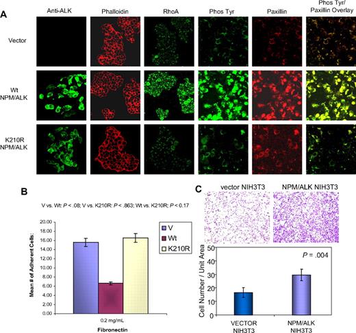 Figure 4. NPM/ALK expression induces changes in proteins associated with cytoskeleton, and affects cell adhesion and invasion. (A) HEK293T cells transfected with vector, wild-type (Wt), and kinase-defective mutant (K210R) NPM/ALK were evaluated by confocal immunofluorescence microscopy for the expression of the cytoskeletal proteins RhoA and paxillin. ALK (green) is expressed in Wt NPM/ALK-transfected HEK293T cells but not in vector-transfected HEK293T cells. The level of ALK expression is slightly decreased in the K210R-transfected cells. The Texas Red–phalloidin (red) staining of the vector-, Wt-, and K210R mutant–transfected cells does not show significant differences in actin expression. The expression of RhoA, paxillin, and phospho-Tyr proteins is significantly reduced in the K210R compared with Wt. (B) HEK293T cells transfected with vector, Wt, or the K210R NPM/ALK were assayed for adhesion to fibronectin. Data represent the mean of 2 experiments with error bars representing SD of triplicate mean. The unpaired Student t test was used (Wt vs K210R, P = .017). (C) The effect of NPM/ALK on invasive properties was evaluated using NIH3T3 cells transfected with vector or Wt NPM/ALK plated onto BioCoat Matrigel invasion chambers, and cells present at the opposite side of the coated membranes were stained with crystal violet. Cells per high-power field (400× magnification) were counted. The graphs represent the results of replicate independent assays.