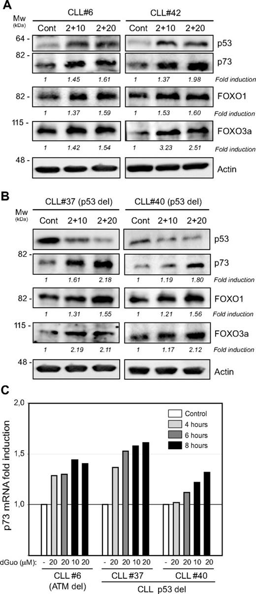 Figure 7. Forodesine treatment triggered an increase of p73 at mRNA and protein levels and the induction of FOXO1 and FOXO3a. (A-B) Cells from 4 representative patients with CLL were treated with forodesine (2 μM) and dGuo (10 and 20 μM) for 16 hours, and p53, p73, FOXO1, and FOXO3a proteins were analyzed by Western blot in total protein extracts. β-Actin was used as internal loading control. Densitometric protein quantification was performed, and p73, FOXO1, and FOXO3a fold inductions with respect to control were calculated. (C) Analysis of mRNA expression by quantitative reverse transcription polymerase chain reaction of p73 in primary cells from 3 patients with CLL treated for 4 to 6 and 8 hours with forodesine (2 μM) and dGuo (10 and 20 μM). mRNA relative levels are given as arbitrary units, using untreated cells as a reference control.