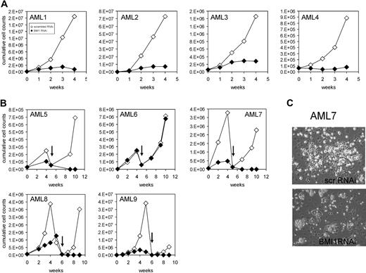 Figure 5. BMI1 is required for long-term growth and self-renewal of AML CD34+ cells. (A) AML CD34+ cells from different FAB subclassification were transduced with scrambled RNAi or BMI1-RNAi lentiviral vectors, and long-term cultures on MS5 bone marrow stromal cells were performed. Expansion was monitored weekly, and cumulative cell counts are shown. (B) Experiment as in panel A, but now transduced AML CD34+ cells were cultured on MS5 for a period of 5 to 6 weeks, after which human CD45+ cells were harvested and replated onto new MS5 cells, followed by an additional culturing period of 4 to 5 weeks. (C) Representative micrographs of cobblestone area-forming cells present in MS5 cocultures at week 4 initiated with AML CD34+ cells transduced with scrambled RNAi or BMI1-RNAi lentiviral vectors. Pictures were taken with a Leica DM-IL microscope (Leica Microsystems) with a 20×/0.30 objective.