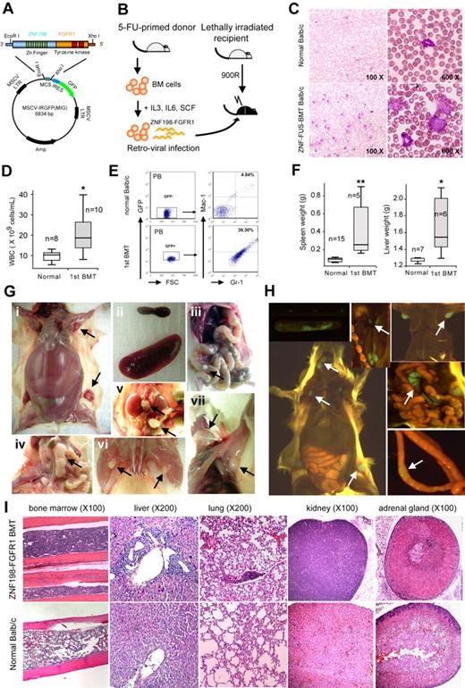 Figure 1. Development of SCLL in ZNF198-FGFR1–transduced BM stem cells. (A) The ZNF198-FGFR1 fusion gene was cloned into the MIG vector containing the murine stem cell virus promoter and GFP cDNA linked by the internal ribosome entry site (IRES). (B) Schematic representation of the experimental approach of retrovirus transduction and transplantation of ZNF198-FGFR1. (C) May-Grünwald-Giemsa staining and (D) hematometric analysis of peripheral blood smears show a significant (P < .05) increase in WBC counts with a population of immature or blast cells in leukemia mice (C bottom right panel). (E) Flow cytometric analysis shows a right shift for both Gr-1–positive and Mac-1–positive myeloid cells in ZNF198-FGFR1 primary recipients expressing GFP. (F) The spleens and livers in leukemia mice are significantly (P < .05, P < .01, respectively) enlarged compared with normal mice. (G) ZNF198-FGFR1 induced distinct SCLL in mice, as evidenced by hepatosplenomegaly (i-ii), and enlarged LNs, Peyer patch (iii), mesenteric (iv), renal and lumbar (v), popliteal (vi), and superficial cervical and axillary (vii) LNs. (H) Molecular imaging shows all LNs displayed GFP fluorescence (see arrows). (I) Histologic analysis shows frequent hypercellularity in BM and infiltration of lymphocytes into various organs of ZNF198-FGFR1 recipients.