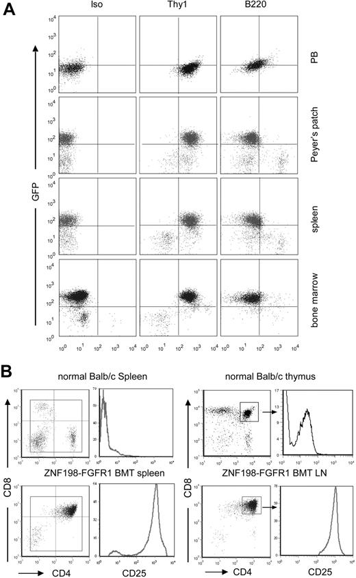 Figure 2. Immunophenotype of hematopoietic cells of the diseased mice. (A) Flow cytometric analysis of different tissue samples, showing high levels of GFP+ Thy1+ cells in all tissues analyzed. (B) The majority of splenocytes and lymphocytes in leukemic mice are CD4 and CD8 DP, with high expression of CD25, compared with CD4+/CD8+ cells isolated from normal thymus.