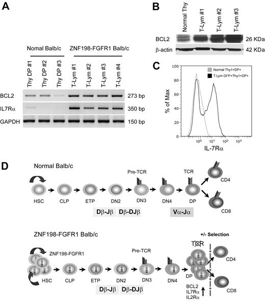 Figure 5. Up-regulation of prosurvival genes protected immature T cells from ongoing apoptosis. (A) RT-PCR shows that transcription levels of Bcl2 and IL7R were remarkably up-regulated in T lymphomas compared with normal Thy1+CD4+CD8+ thymocytes. (B) High expression of BCL2 protein was also seen in T lymphoma versus that in normal BALB/c thymus by immunoblotting. (C) Flow cytometric analysis with anti-IL7Rα (CD127-PE) showing cell membrane IL7Rα expression levels in Thy1+DP lymphoma cells is approximately 10 times higher than that seen in normal Thy1+DP thymocytes. (D) A proposed mechanism for T-lineage lymphoblastic lymphoma development in the ZNF198-FGFR1 mouse model. The top panel from a normal mouse shows that early thymocyte progenitors (ETP) migrate from BM common lymphoid progenitors (CLP) into the thymus, and then sequentially differentiate into CD4−CD8− double-negative and CD4+CD8+ DP cells after Tcrb and Tcra rearrangements. Cells that express a TCR-CD3 complex can pass through both positive and negative selection and differentiate into CD4+, CD8+ mature T cells, or natural killer T cells (data not shown). The bottom panel proposes that self-renewal of hematopoietic stem cell (HSC) is accelerated when the ZNF198-FGFR1 fusion kinase is expressed. Concordantly, constitutive activation of high expression of pre-Tα promotes the progenitors to differentiate into DP cells, although loss of Tcra prevents immature T cells from forming a functional TCR-CD3 cell-surface complex, which results in arrested T-cell development at the DP stage. Furthermore, due to high expression of BCL2, IL2Rα, and IL7Rα, these DP cells can escape apoptosis and maintain high rates of cell proliferation.
