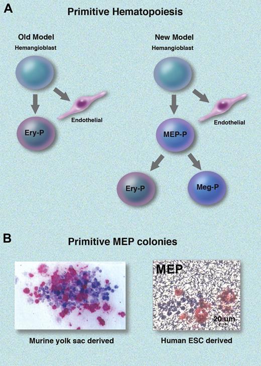 Old and new models for yolk sac primitive hematopoiesis. (A) Previous models indicated that primitive (P) erythrocytes develop directly from a yolk sac vascular-endothelial precursor termed the hemangioblast.2 New data extend the hematopoietic repertoire of yolk sac hematopoiesis by defining a bipotent primitive MEP that gives rise to erythrocytes (Ery) or megakaryocytes (Meg), which then mature into platelets (not shown). Data by Tober et al indicate that the primitive MEP is hemangioblast derived.6 (B) Bi-lineage erythro-megakaryocytic colonies arising from single primitive MEPs. The right panel shows a colony derived from human ESCs (adapted from Figure 4 of the article beginning on page 1506). Megakaryocytes are stained with anti-CD41 (pink). The left panel shows a colony derived from mouse yolk sac. Erythrocytes are stained with anti-βH1 globin (blue); megakaryocytes are stained with anti-GP1bβ (red). Adapted with permission from Tober et al.6 Professional illustration by Marie Dauenheimer.