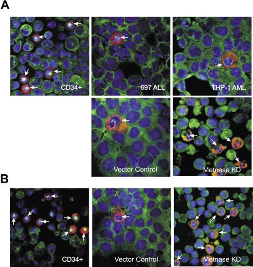 Figure 4. Photomicrographs showing that leukemia cells show a reduced mitotic arrest after ICRF-193 and restoration of mitotic arrest with reduced Metnase. (A) Images showing both tubulin (green) and MPM-2 (red) staining, as well as counterstaining with DAPI, after 10 μM ICRF treatment for 24 hours. There are more cells arrested in mitosis after ICRF-193 in the CD34+ cells than in the THP-1 AML cells. When Metnase is repressed in the THP-1 cells, the fraction of cells in mitosis after ICRF-193 exposure becomes similar to that seen with CD34+ cells. (B) Similar to panel A, but treated with 25 μM ICRF for 24 hours.