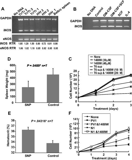 Figure 6. The inhibitory effect of T6 cells on the proliferation of erythroleukemic cells is partially mediated through the NO pathway. (A) RT-PCR analysis of iNOS and eNOS expression in spleens (n = 3) isolated from Tr/Tr and H/H mice. Normal Balb/c splenic RNA was used as control. (Bottom panel) Real-time PCR ratios (RTR) for iNOS and eNOS in the isolated spleens. (B) RT-PCR analysis of iNOS expression in T6 cells after 2 days of incubation with the indicated cytokines. An untreated T6 cell sample was designated as a control. (C) Effects of the iNOS inhibitor, 1400W, on the proliferation of erythroleukemic cells. CB3 cells were cultured in the presence of 10% FBS and T6 supernatant (10%), T6 supernatant + 1400W or 1400W alone. The number of viable cells was determined at the indicated time points using the trypan blue exclusion assay. (D) Balb/c neonates were infected with F-MuLV. At 5 weeks after infection, mice were treated daily with SNP (10 μg/100 μL) or PBS for a period of 2 weeks. At the end of treatment, mice were killed, and spleen weights (D) and hematocrit values (E) were determined. *Significant difference between the 2 groups. Error bars represent ± SD. (F) PV patient serum inhibits the growth of human erythroleukemia in culture. HEL cells (104) were cultured in the presence of 10% FBS and either normal or PV patient serum with or without 1400W (10 μM). Viable cells were counted on the indicated days using trypan blue exclusion assay. Graphs show the effect of serum from PV patient 1 (PV1) and normal person 1 (N1).