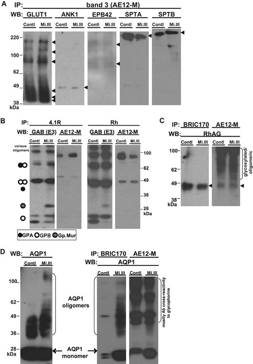 Figure 2. iTRAQ™ validation by immunoblot. Equal quantities of ghost lysates were pooled from 6 to 8 donors per group (control vs Mi.III) for IP, and one-tenth of the pulldown (vol/vol) was loaded onto 4% to 12% SDS-polyacrylamide gel electrophoresis for immunoblot comparison. (A) Immunoblots confirmed that glucose transporter type I, ANK1, EPB42, α spectrin, and β spectrin were not quantitatively different in AE1 immunoprecipitates from both groups. The pulldown experiments were repeated 2 to 8 times, and IP was also confirmed using another anti-AE1, BRIC170 (data not shown). (B) Both anti-4.1R and anti-Rh antibodies pulled down GPA, GPB, Gp.Mur, and AE1, indicating that 4.1R and Rh polypeptides were part of the AE1-based complexes. (C) Rh-associated glycoprotein was coimmunoprecipitated with AE1. AE1 IP was repeated and confirmed with both anti-AE1 (AE12-M and BRIC170). (D) AQP1 was more substantially associated with AE1 on Mi.III+ membrane. (Left) AQP1 immunoblot of the pooled ghost lysates showed similar expression levels for both Mi.III and the control. (Right) Both anti-AE1 antibodies coimmunoprecipitated more AQP1 from Mi.III. The coimmunoprecipitation experiment has been repeated and confirmed 7 times.
