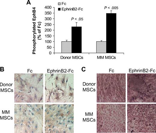Figure 2. EphrinB2-Fc induces forward signaling in MSCs. (A) Donor and patient MSCs were starved overnight and stimulated with clustered ephrinB2-Fc (4 μg/mL) for 20 minutes before being assayed for phosphorylated EphB4 using ELISA. Note induction of EphB4 phosphorylation by ephrinB2 in donor and patient MSCs. (B) Donor and patient MSCs cultured in osteogenic media were treated with Fc or clustered ephrinB2-Fc (4 μg/mL) for 5 days and then subjected to immunohistochemical staining for osteocalcin. Note that, although ephrinB2-Fc increased expression of osteocalcin in both types of MSCs, the effect of the chimeric protein on osteoblast differentiation (mineralization) was more profound in donor MSCs. (C) Accumulation of calcium as determined by von Kossa staining (brown) in MSCs treated with Fc or ephrinB2-Fc for 10 days. Note increased calcium deposition by ephrinB2-Fc in both types of MSCs and stronger staining in donor MSCs than patient MSCs. Similar results were obtained in MSCs from 3 donors and patients with MM.