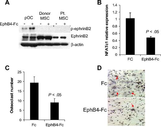 Figure 3. EphB4-Fc induces reverse signaling in osteoclast precursors but not in MSCs. (A) Osteoclast precursors (pOC) and MSCs from donors and MM patients were left untreated or stimulated with clustered EphB4-Fc (4 μg/mL) for 20 minutes and then subjected to Western blot. Note that ephrinB2 was expressed in pOC and MSCs (∼ 50-kDa band size) and that EphB4-Fc induced phosphorylation of ephrinB2 in pOC but not in donor or MM patient MSCs. (B) Human pOCs were treated with Fc or EphB4-Fc for 2 days and then subjected to quantitative RT-PCR for NFATc1 (ephrinB2 target). Note down-regulation of NFATc1 by EphB4-Fc. (C-D) Human pOCs were treated with Fc or EphB4-Fc for 7 to 10 days and then stained for TRAP. Note reduced number of TRAP-expressing multinucleated osteoclasts (red arrows) in EphB4-Fc–treated cultures.