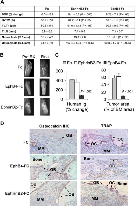 Figure 4. EphrinB2-Fc and EphB4-Fc affect MM bone disease and tumor growth in SCID-hu mice. SCID-hu mice (n = 15) engrafted with primary myeloma cells from a single patient were treated with Fc, ephrinB2-Fc, or EphB4-Fc (5 mice/group) for 4 weeks using Alzet pumps that released 0.11 μg/hr of each compound directly into the implanted bones. (A) Changes in BMD of the implanted bone from pretreatment levels, histomorphometric parameters, and numbers of osteocalcin-expressing osteoblasts and TRAP-expressing osteoclasts in myelomatous bones. Note EphrinB2-Fc and EphB4-Fc increased bone formation and osteoblast numbers, but only EphB4-Fc reduced the number of osteoclasts. (B) Representative x-ray radiographs of myelomatous bones treated with indicated agents. Note that, in contrast to Fc, ephrinB2-Fc and EphB4-Fc treatment resulted in increased bone mass. (C) Changes in human Ig levels (left panel) and MM tumor area (right panel) in the implanted human bone after treatment with control Fc, ephrinB2-Fc, or EphB4-Fc for 4 weeks. Note inhibition of MM growth by EphB4-Fc but not ephrinB2-Fc. (D) Representative bone sections with immunohistochemical (IHC) staining for osteocalcin (left panels) or stained for TRAP (right panels). Note that ephrinB2-Fc and EphB4-Fc increased numbers of osteoblasts, but only EphB4-Fc reduced numbers of osteoclasts in myelomatous bones.