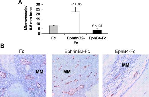 Figure 5. EphrinB2-Fc and EphB4-Fc affect neovascularization in myelomatous bone. Human bone sections from myelomatous SCID-hu mice treated with Fc, ephrinB2-Fc, or EphB4-Fc were immunohistochemically stained for human CD34. (A) Numbers of human CD34-reactive neomicrovessels in myelomatous bones were increased by ephrinB2-Fc and reduced by EphB4-Fc treatment. (B) Representative immunohistochemical staining for CD34, demonstrating the effect of ephrinB2-Fc and EphB4-Fc on MM-induced neovascularization.