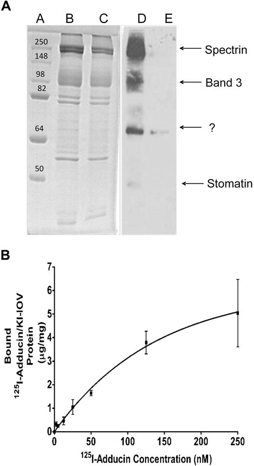 Figure 1. Adducin-binding proteins in KI-IOVs revealed by label transfer and copelleting experiments. (A) β-Adducin–binding proteins in IOVs revealed by label transfer experiments. Purified β-adducin tail (expressed in E coli) was incubated in the dark with a 2-fold molar excess of sulfo-SBED for 3 hours at 4°C, after which the protein solution was dialyzed overnight against PBS to remove unbound sulfo-SBED. IOVs (200 μg protein) were incubated with the above labeled β-adducin tail for 1 hour at room temperature in the dark to allow membrane association, after which cross-linking to nearest neighbor proteins was activated on ice by exposure for 15 minutes to a 302-nm light source (18.4 W) at a distance of 5 cm. A total of 10 mM dithiothreitol was then added to reduce the disulfide linkage between sulfo-SBED–adducin and its membrane anchor, and the labeled membrane anchor containing the transferred biotin was analyzed by SDS-PAGE, followed by transfer to nitrocellulose and visualization with streptavidin–horseradish peroxidase. Coomassie blue–stained gel lanes A through C contain molecular weight standards (lane A), or IOVs incubated with labeled β-adducin tail either in the absence (lane B) or presence (lane C) of a 20-fold excess of unlabeled β-adducin tail to competitively block all adducin binding sites on the IOVs. Lanes D and E represent streptavidin–horseradish peroxidase blots of lanes B and C. (B) KI-IOVs (100 μg) were incubated with increasing amounts of 125I-adducin (purified from mature erythrocytes) or 125I-BSA (60 μL total volume) for 2 hours at room temperature in a buffer consisting of phosphate-buffered saline containing 10% sucrose, protease inhibitor mixture, 1 mg/mL BSA, and no Mg2+. Bound proteins were separated by centrifugation through a 25% sucrose cushion and quantified by γ counting. The BSA control was subtracted. Data points represent mean ± SD, n = 2. An apparent KD of approximately 100 nM was calculated assuming a noncooperative, single site–binding equilibrium.