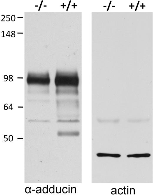 Figure 4. Intact band 3–null erythrocytes have reduced adducin content. Intact erythrocytes from wild-type (+/+) and band 3–null (−/−) mice were washed, plunged into 5× SDS-PAGE sample buffer, separated by SDS-PAGE, blotted onto nitrocellulose, and visualized with antibodies to adducin (left) and actin (right). Quantitative densitometry of 2 independent samples demonstrates a 35% decrease in adducin content of −/− erythrocytes.