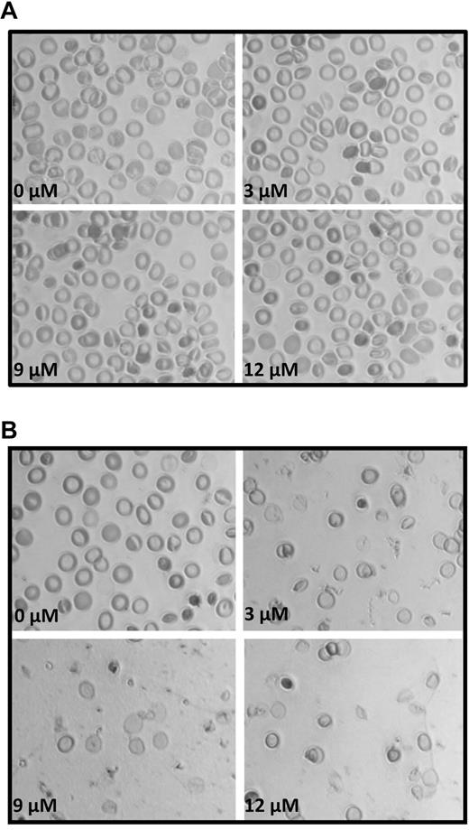 Figure 5. Analysis of the morphology of erythrocytes resealed in the presence of α- and β-adducin tail domains. Increasing concentrations of (A) α- and (B) β-adducin tail domains (0-12 μM) were incubated for 1 hour on ice with leaky erythrocytes (500 μL) at 50% Hct and then resealed for 45 minutes at 37°C in PBS containing 4 mM MgCl2.