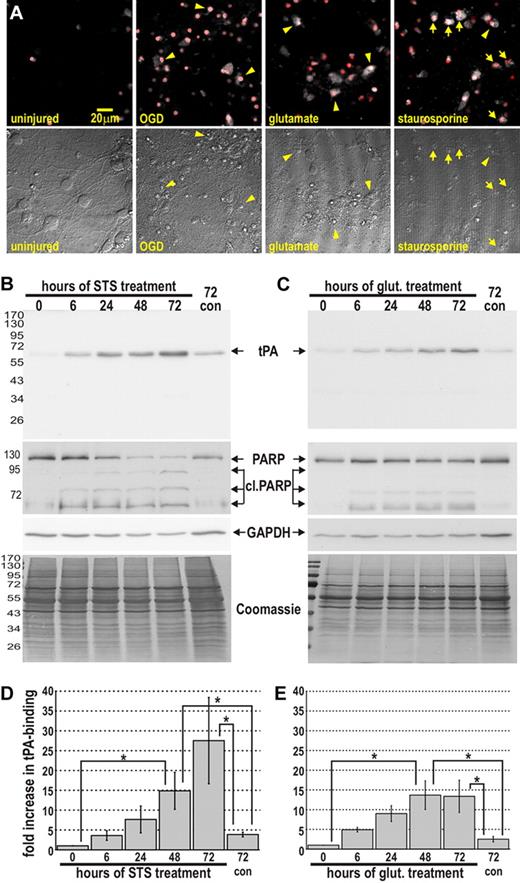 Figure 1. tPA binds to injured neurons in vitro. (A) Neuronal cultures were exposed to OGD, glutamate, or staurosporine for 72 hours. Cultures were then perfused with 10 μg/mL 7AAD and 10 nM tPA633 for 5 minutes and then imaged sequentially by confocal microscopy. Micrographs in the top row represent an overlay of 7AAD fluorescence (red) and tPA633 fluorescence (white). The bottom row of micrographs shows the corresponding bright-field images. Arrowheads indicate examples of necrotic cells. Arrows indicate examples of apoptotic cells. Appropriate “bleed-through” controls were conducted to ensure specific signal detection (not shown). (B-E) Neuronal cultures were treated with staurosporine (B,D) or glutamate (C,E). At increasing time intervals, cultures were incubated with 400 nM tPA for 15 minutes and washed, and then cellular proteins harvested and subjected to immunoblot analysis. (B-C) Representative immunoblots for tPA, full-length PARP, cleaved PARP (cl PARP), and GAPDH. A Coomassie stain of each membrane is shown as a loading control. “72con” refers to lysates from uninjured cultures at 72 hours. Note, endogenous tPA expression is low in our neuronal cultures and could not be detected by immunoblot analysis (not shown). (D-E) Densitometric quantitations of tPA-binding from 3 independent experiments (normalized for GAPDH levels). Data represent average ± SEM. *P < .05 by 1-way ANOVA with Neumann-Keuls correction.