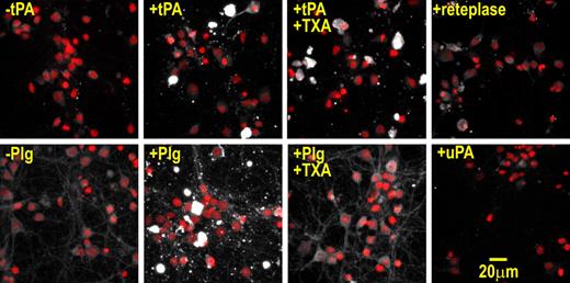 Figure 4. tPA and plasminogen bind to injured neurons via different mechanisms. Neuronal cultures were incubated in B27 protein–containing media supplemented with 400 nM tPA, 100 nM plasminogen, 10 mM TXA, or 400 nM reteplase or 800 nM uPA for 15 minutes. Cultures were then washed, fixed, and subjected to anti-tPA/anti-plasminogen/anti-uPA immunofluorescence. Samples were imaged by confocal Z-stack analysis. Shown are maximum projection micrographs where immunopositive signals (white) and nuclear counterstain signals (red) are overlaid. These results were reproduced across at least 3 independent experiments. Note, the immunopositive signals of nonviable cells are so intense that the nuclear counterstain of these cells is not seen in the overlay. In addition, no comparable immunopositive cells were found in sections that were incubated in the absence of tPA, plasminogen, or reteplase. Immunoblot analysis demonstrated that the anti-tPA antibody binds tPA and reteplase with comparable affinities (not shown). Binding to nonviable cells was still apparent when the concentration of tPA was lowered to 50 nM (not shown).