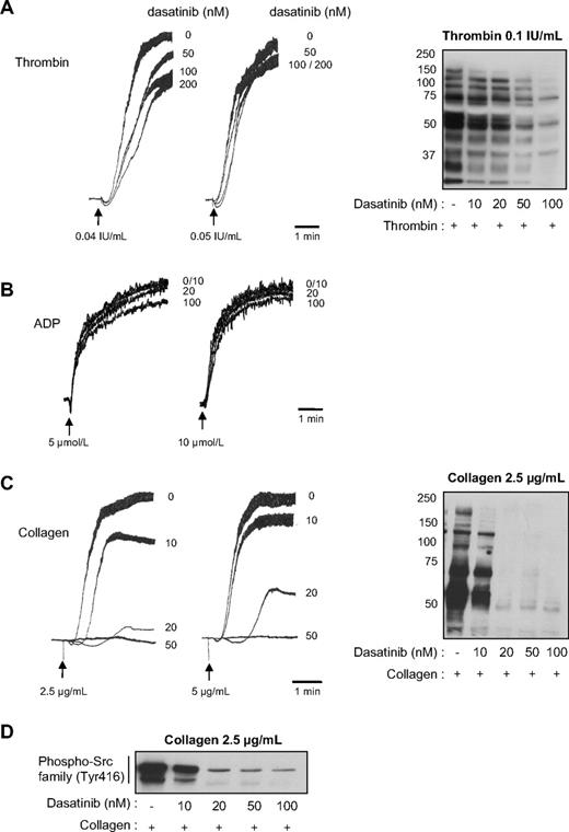 Figure 1. Effect of dasatinib on human platelet aggregation and tyrosine phosphorylation on thrombin or collagen stimulation. Platelets from healthy donors were treated or not with increasing concentrations of dasatinib for 15 minutes and stimulated with (A) thrombin, (B) ADP, or (C) collagen. Platelet aggregation was assessed using a Chrono-log dual-channel aggregometer under stirring at 900g. The aggregation profiles shown are representative of 3 independent experiments. Right panels show the effect of dasatinib on whole platelet tyrosine phosphorylation pattern in response to thrombin or collagen. Results are representative of 3 independent experiments. (D) Western blot analysis of phospho-Src family (Tyr416) in human platelets incubated with increasing doses of dasatinib and stimulated by 2.5 μg/mL collagen for 3 minutes. The Western blots shown are representative of 3 independent experiments.