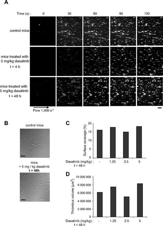 Figure 5. Reversible effect of dasatinib on platelet thrombus formation under arterial flow conditions. DiOC6-labeled platelets in whole blood from control mice or mice treated with dasatinib (5 mg/kg) 4 or 48 hours before blood collection were perfused through a collagen-coated microcapillary at a shear rate of 1500 seconds for 2 minutes. Thrombus formation was visualized and analyzed as in Figure 3. Representative images of platelet adhesion from control and treated mice are shown (A-B). Scale bar represents 20 μm. Area covered by platelet thrombi (C) and thrombus volume (D) were measured at 2 surface locations in each of 3 different conditions 48 hours after oral administration of dasatinib (1.25, 2.5, or 5 mg/kg as indicated). Results shown are mean values of 2 independent experiments.