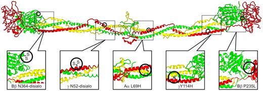 Figure 1. Structural locations of fibrinogen variants in patients with CTEPH. The positions of the alterations expected from the various mutations are illustrated on a ribbon model of chicken fibrinogen.21 In fibrinogenSan Diego I, the oligosaccharides attached to Bβ Asn-364 and γ Asn-52 are excessively disialylated, which imparts negative charges to the regions, thereby promoting the formation of “thin” fibrin fibers.22,23 A similar situation exists for fibrinogenSan Diego V (Aα R554H), in which the arginine→histidine substitution would also reduce the net charge in that region (not shown because it occurs in a region too flexible for crystallographic resolution). In fibrinogenSan Diego II (γ Y114H) and fibrinogenSan Diego IV (Aα L69H) the substitutions result in the insertion of a polar imidazole side chain within the “helix-permissive” hydrophobic center of the coiled coil,24 which could disrupt the molecular structure. In fibrinogensSan Diego I-III, the Bβ P235L substitution occurs at an articulation site in the βC region that ordinarily allows exposure of a t-PA binding site within the coiled coil. Substitution of leucine for the conformationally rigid proline in this area could affect the flexibility between the βC region and the coiled coil,14 which normally allows exposure of a region (circa Aα-157) that has been implicated in the activation of t-PA by fibrin.25